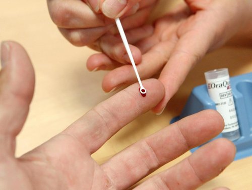 VIH : le dépistage a progressé en 2022 mais les préjugés restent tenaces
