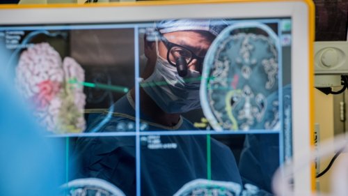Gehirn-Computer-Schnittstelle:Mensch denkt, Maschine spricht