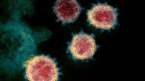 Meldungen zum Coronavirus:81 417 Neuinfektionen an einem Tag - Inzidenz steigt