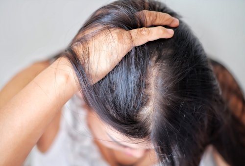 Female Pattern Hair Loss Is Real: A Powerful Solution To This Common Problem In Women