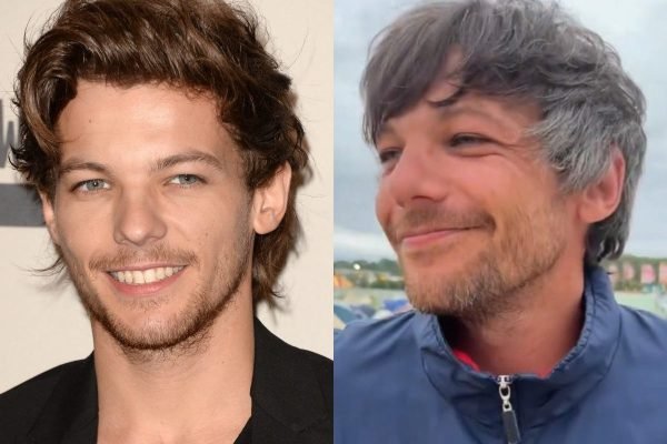 One Direction's Louis Tomlinson Shocks Fans With Wild Hair Transformation
