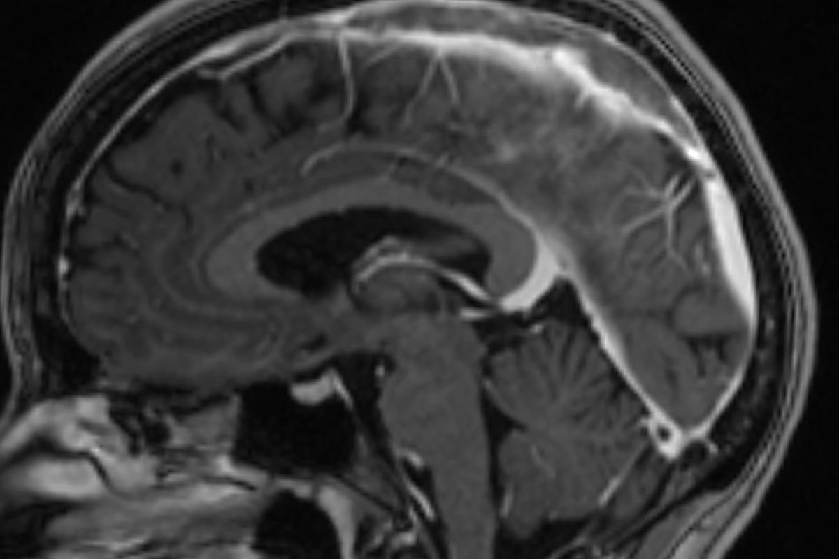 ’90s music legend facing aggressive brain cancer battle