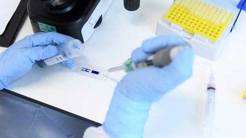 Des nouveaux traitements contre le cancer de l'ovaire en test à Genève