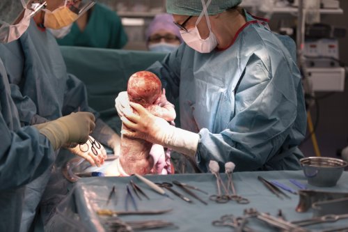 Warum am Wochenende weniger Babys zur Welt kommen