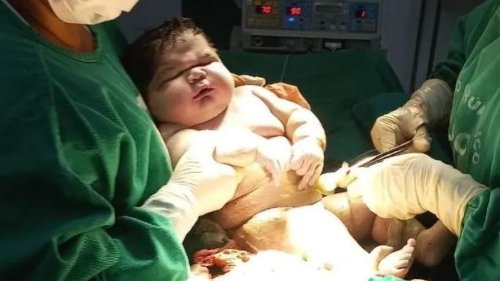 Brasilien: Riesenbaby zur Welt gekommen