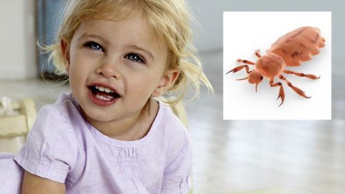 Zecken, Würmer, Läuse: Die häufigsten Parasiten bei Kindern