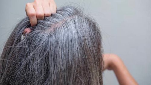 Uzmanı açıkladı: Luteolin açısından zengin sebzeler, saç beyazlamasını geciktiriyor!