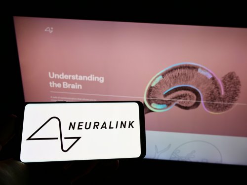 Neuralink: Musk soll zu Todesfällen von Versuchsaffen gelogen haben