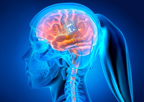 Neuralink will Hirnimplantate am Menschen testen
