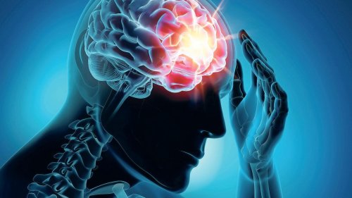 Paradigmenwechsel in der Migräne-Therapie?: Neues Medikament hilft gegen frühe Symptome