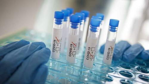Inzidenz steigt am fünften Tag in Folge – auf nun 6,9