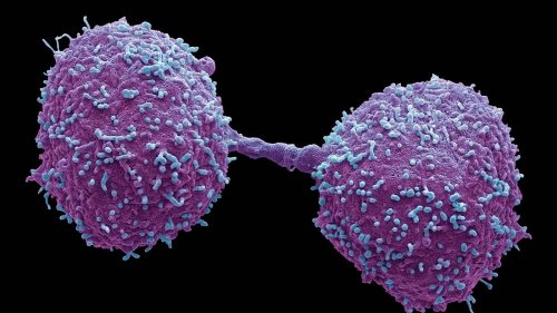 Berliner Forscher entwickelt Bluttest zur Frühdiagnose: Ist das der Anfang vom Ende von Krebs?