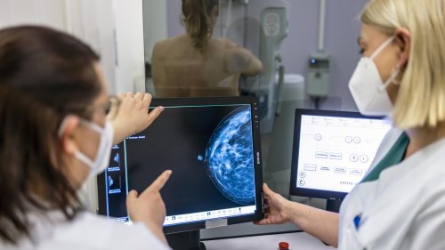 Abtasten hilft nicht: Was Frauen für die Früherkennung von Brustkrebs tun können