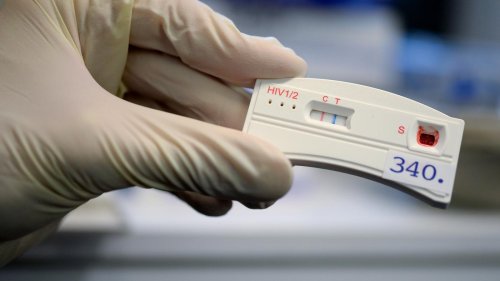 Ist die Krankheit wieder auf dem Vormarsch?: Zahl der HIV-Meldungen in Brandenburg steigt