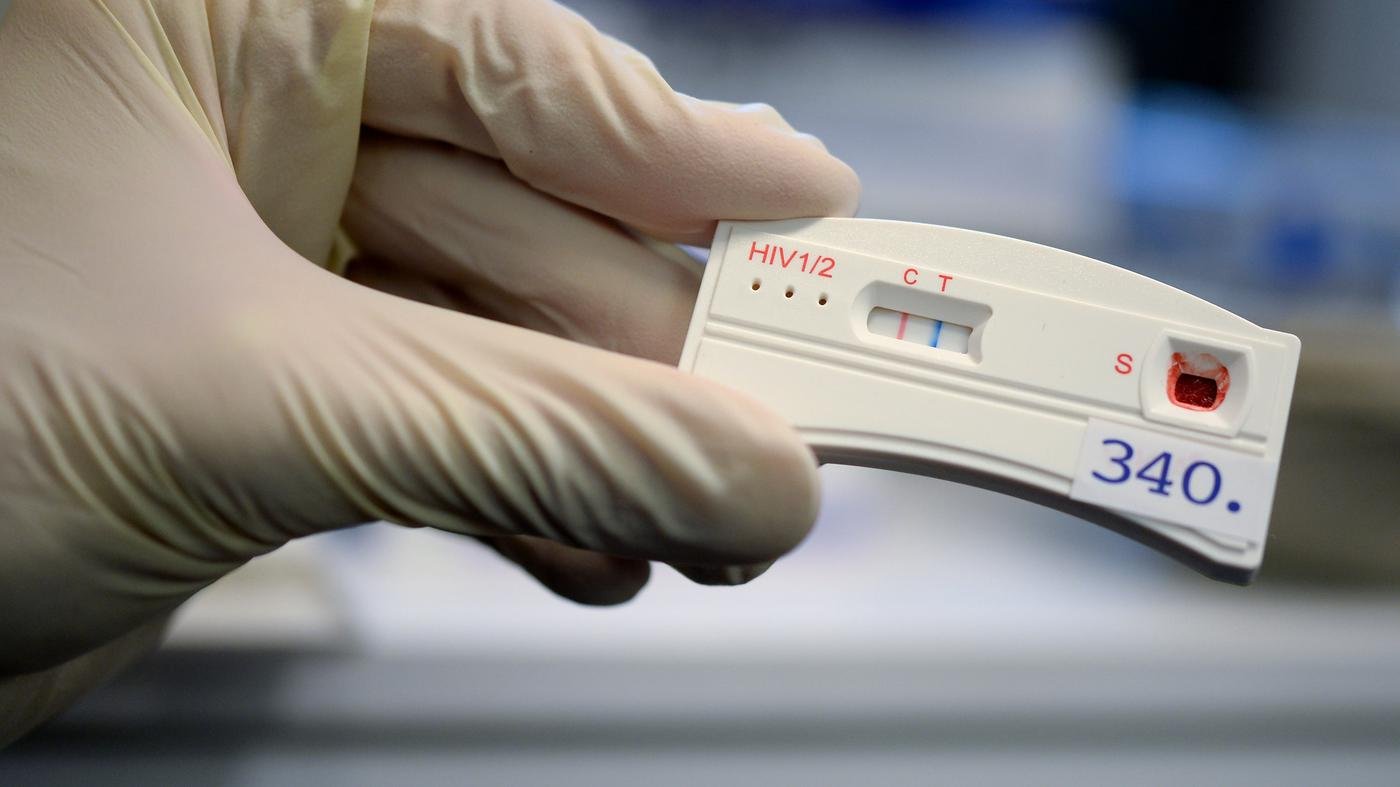 Auch wegen Tests zu Hause: Zahl der HIV-Meldungen in Brandenburg steigt