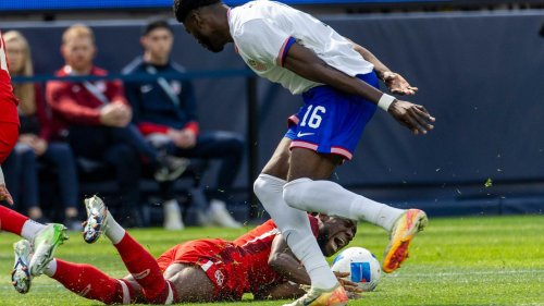 FC Bayern München: Verletzter Davies gibt Entwarnung nach Auswechslung