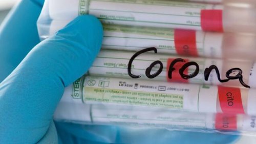 Länder-Gesundheitsminister wollen Verfügbarkeit von PCR-Tests radikal einschränken