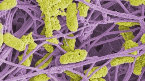 Pflaster mit Mikroben: Hausmittel gegen offene Wunden