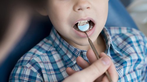 Bröselnde Zähne: „Wenn der Zahnarzt mit Luft durch den Mund pustet, gehen die Kinder an die Decke“