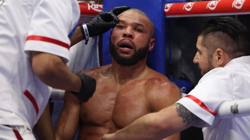 Fans fear for Chris Eubank Jr as he’s taken to hospital minutes after Conor Benn fight: ‘Broken for sure’