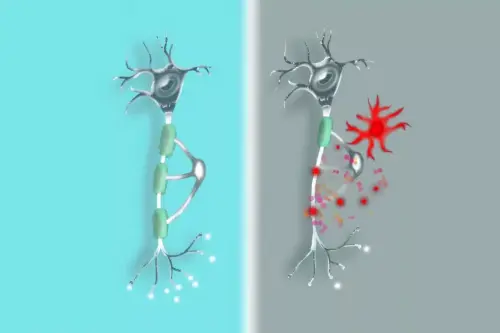 CAR-T cell therapy causes mild cognitive impairments