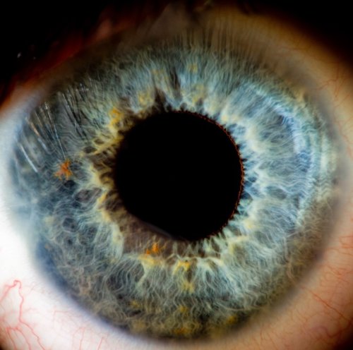 In First Human Test of Optogenetics, Doctors Aim to Restore Sight to the Blind