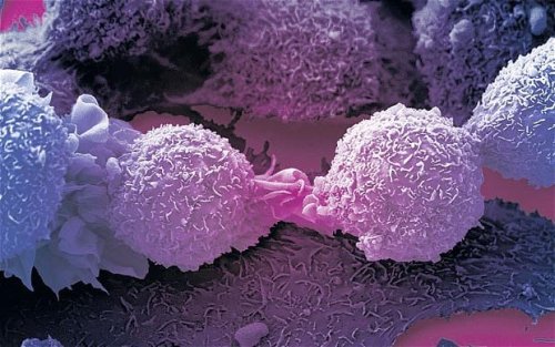 Scientists find key to 'turbo-charging' immune system to kill all cancers