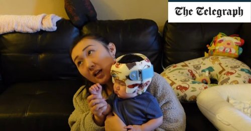 ‘Momfluencers’ force children into ‘correction helmets’ that reshape their skulls