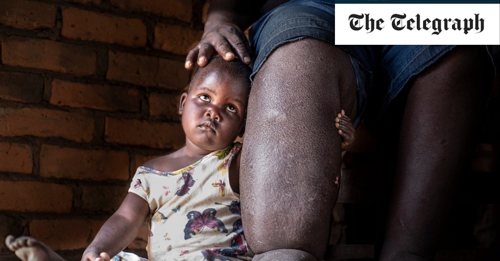 'They're called neglected for a reason': tackling the world's forgotten diseases during Covid
