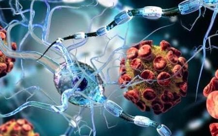 Multiple sclerosis: New stem cell transplantation may 'freeze' disease progression
