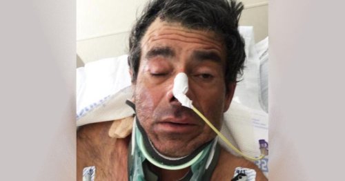Un hispano lleva semanas en un hospital de California sin poder recordar quién es. Las autoridades piden ayuda