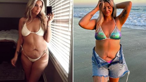 Body Talk I have stretch marks, cellulite and a belly – I won’t stop showing off my real mum bod, men get praised for it