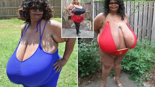 I’ve got world’s biggest boobs – women call them gross but I refuse to reduce my ZZZ cups… I’m a natural Katie Price