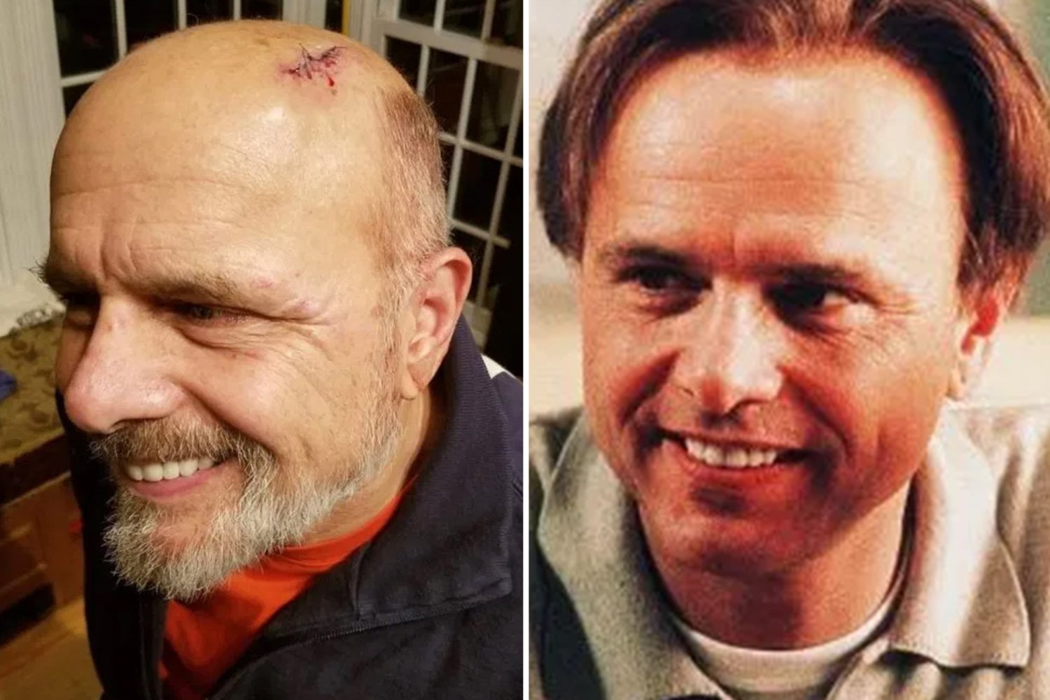 'NEAR DISASTER' Sopranos’ Joe Pantoliano suffered a concussion and got 10 stitches for ‘bloody head gash’ after ‘horrific’ car strike