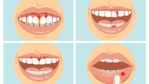The 7 things your teeth can tell you about your health – and when to panic