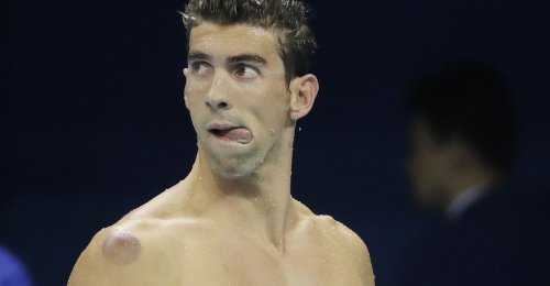 Please, Michael Phelps, Stop Cupping