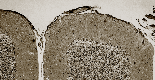 The Cerebellum Isn’t What We Thought