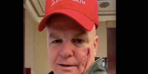 Retired NYPD officer says woman punched him in face, left it bloody on his birthday over red cap that looks like MAGA hat | Blaze Media