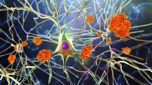 Breakthrough study reveals why certain brain diseases affect men and women differently