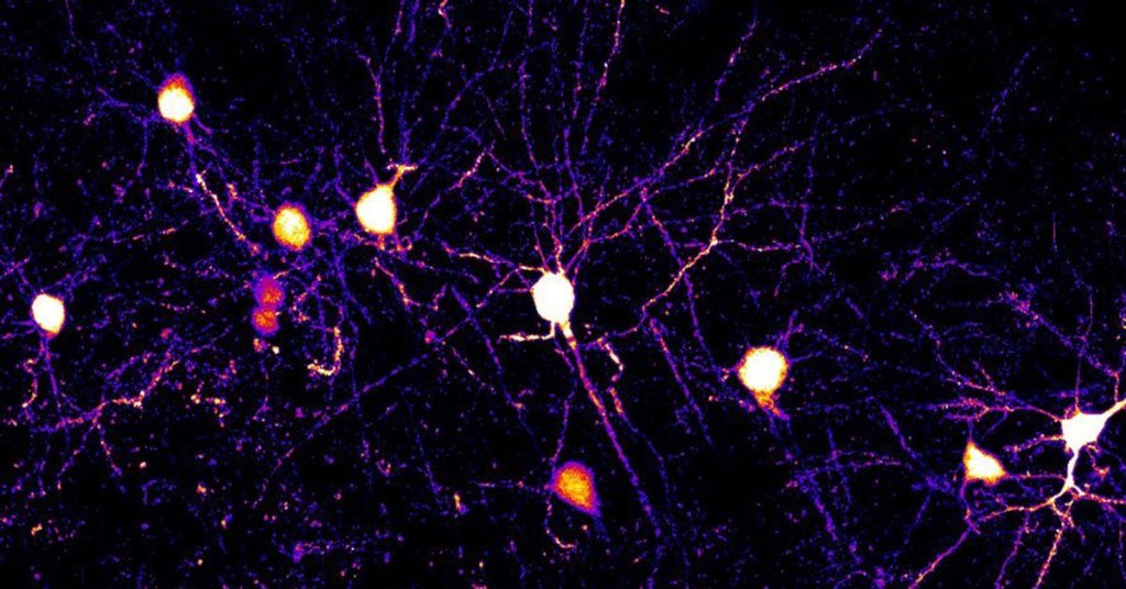ALZHEIMERS & DEMENTIA