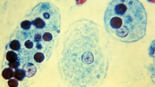 Strange parasite kills human cells and wears their remains as disguise