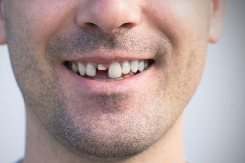 Lifechanging drug regrows teeth in humans