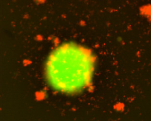 New ‘smart’ immune cells continuously hunt and kill cancer cells