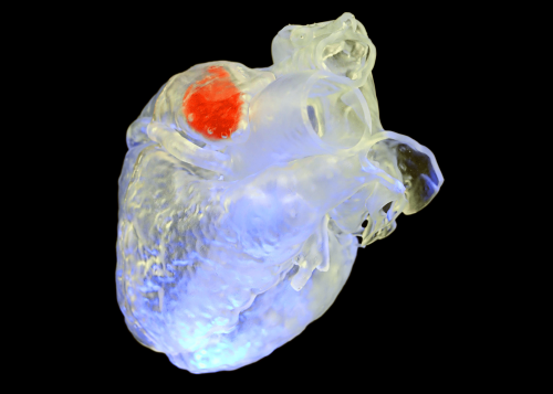 New light-activated heart tissue revolutionizes heart repair