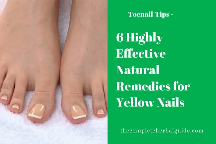 6 Ways to Clear Up Yellow Toenails