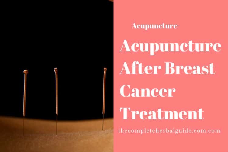 Acupuncture After Breast Cancer Treatment