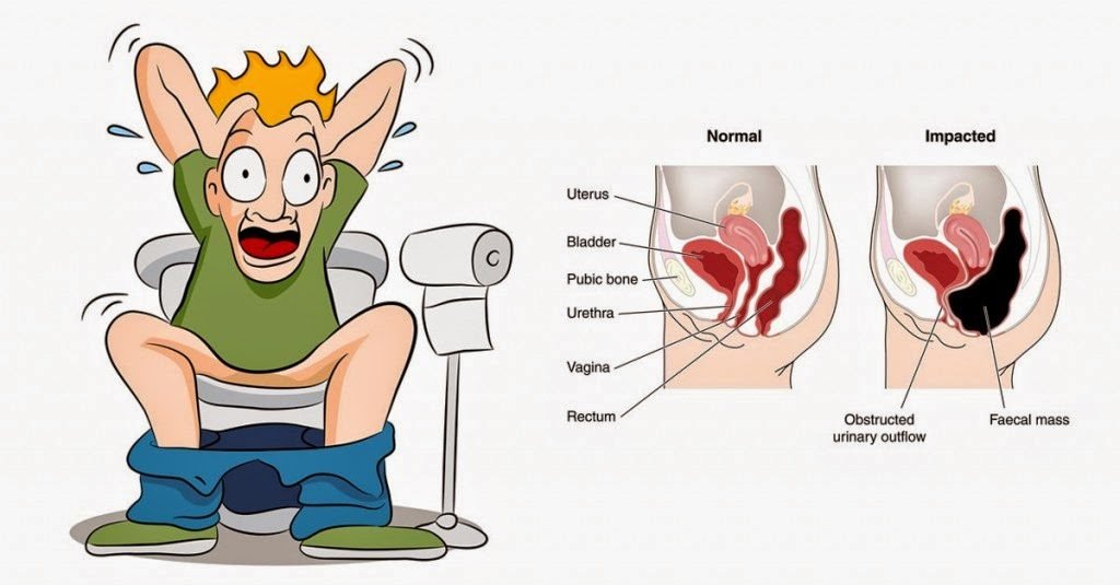 How To Relieve Constipation Quickly and Naturally