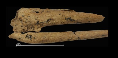 World's Earliest Evidence Of A Successful Surgical Amputation Found In ...