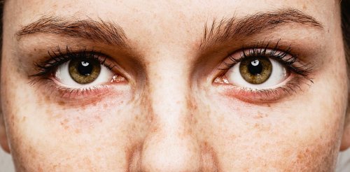 Ce que vos yeux révèlent de votre santé