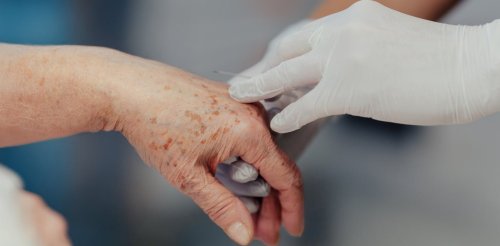Augmentation du nombre d’euthanasies en Belgique, que révèle cette statistique ?
